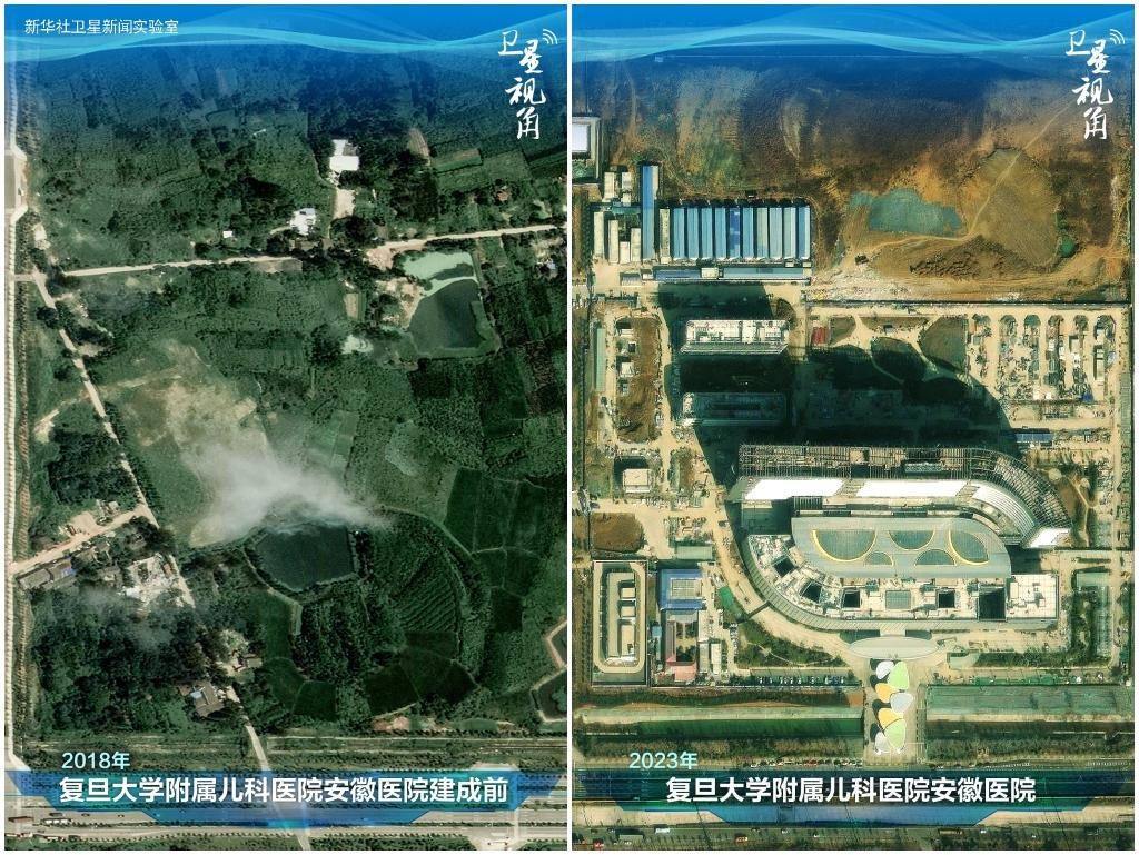 2023年與2018年相比，復旦大學附屬兒科醫(yī)院安徽醫(yī)院從一片荒地到建成投用。該項目是安徽省在長三角一體化高質量發(fā)展衛(wèi)生健康領域的重大項目，也是安徽首批落地的國家區(qū)域醫(yī)療中心。